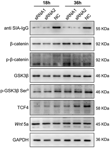 Figure 6. SIA-IgG may regulate biological features of breast cancer cells through Wnt/β-catenin pathway via mediate GSK3β. Detection of Wnt/β-catenin pathway related proteins by western blotting analysis in protein extracted from MDA-MB-231 cells which knocked IgG by siRNAs.