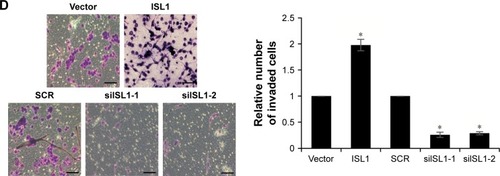 Figure 5 ISL1 facilitates breast cancer cells migration and invasion.