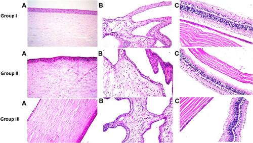 Figure 6 Photomicrographs presenting histopathological sections (stained by hematoxylin and eosin) of normal untreated rabbit eye (group 1), rabbit eye treated with CLT suspension (group 2) and rabbit eye treated with S1 (group 3). (A) Shows histological structure of the cornea, (B) Shows histological structure of the iris and (C) Shows histological structure of the sclera, retina and choroid.