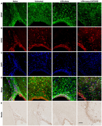 Figure 4 Increasing the amounts of biological markers (Nestin, GFAP and SOX2) and restoring the movement and activity of NPCs show that giving SOD-CAT-PLGA-NPs with tPA improved neurogenesis after stroke. (A-D) Immunofluorescence was used to identify the expression of GFAP (A), SOX2 (B), and DAPI (C) in different groups of the subventricular zone and rostral migratory stream. The resulting figures were merged (D). (E) Immunohistochemical analysis was used to identify the expression of Nestin in different groups of the subventricular zone and the rostral migratory stream. Scale bar = 50 mm. Reprinted from Biomaterials. Volume: 81, Petro M, Jaffer H, Yang J, Kabu S, Morris VB, Labhasetwar V. Tissue plasminogen activator followed by antioxidant-loaded nanoparticle delivery promotes activation/mobilization of progenitor cells in infarcted rat brain. 169–180, Copyright 2022, with permission from Elsevier.Citation38