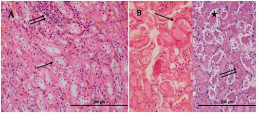 Figure 8. The histopathological evaluation of the renal tissue of RIR group. *Hyalin cast accumulation in dilated tubuli.