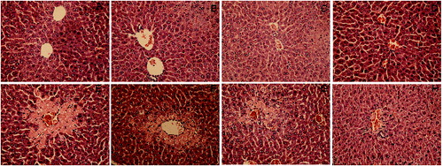 Figure 2. Pathological changes of liver tissues in each treatment group. H&E staining of liver section from (A) blank control group; (B) 25 mg/kg silymarin treatment group; (C) 100 mg/kg DHP1A treatment group; (D) 200 mg/kg DHP1A treatment group; (E) CCl4 treatment group; (F) 25 mg/kg silymarin + CCl4 treatment group; (G) 100 mg/kg DHP1A + CCl4 treatment group and (H) 200 mg/kg DHP1A + CCl4 treatment group.
