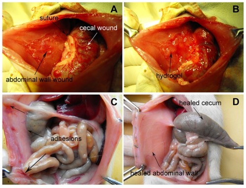Figure 2 (A) The rat model of abdominal sidewall defect-cecum abrasion. (B) PECE hydrogel applied on the injured abdominal wall and cecum. (C) Score-4 adhesion was observed between the injured abdominal wall and cecum in an NS-treated rat; intestine segments and omentum adhesion to the sutured midline incisions were also observed. (D) No adhesion was observed in the PECE gel-treated group.Abbreviations: NS, normal saline; PECE, poly (ethylene glycol)-poly (ɛ-caprolactone)-poly (ethylene glycol) (PEG-PCL-PEG).