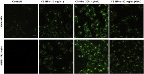 Figure 4. Confocal images of the distribution of GFP-LC3B (green fluorescence) in Hela cells and SMMC-7721 cells after being incubated with CS NPs for 24 h. Scale bar: 50 μm.