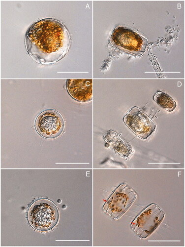 Figure 1. DIC light microscopy of Miracula islandica at different life cycle stages in the centric marine diatom Minidiscus sp. (A) Early infection stage, with developing endobiotic thallus close to the host nucleus; (B, C) developing thallus at an early stage of development (B), surrounded by orange-brown to chestnut-colored residues (C); (D) mature thallus surrounded by degraded phaeoplast residues in multiple infected host cells in chains of Minidiscus sp.; (E) final stage of zoospores maturation, with almost fully developed zoospores compacted within the thallus; (F) empty sporangium, each with a single short discharge tube with a slightly thickened base (red arrows) and surrounded by smooth colorless spherical wall. Scale bar = 50 µm in all photos.