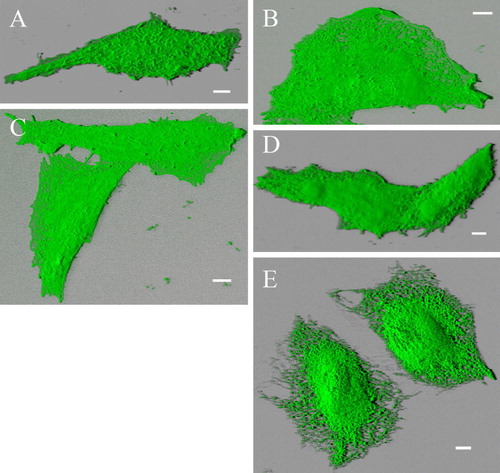 Figure S2.  Blended 3D projection of the GFP channel reveals plasma membrane- and ER-localization of different deletion mutants. Alternative blended shadow projection reveals evidently plasma membrane localization of truncation mutants Δ856-871-GFP (A), Δ845-871-GFP (B), Δ841-871-GFP (C) and Δ829-871-GFP (D) double transfected with RFP-TRPV4 in CHO cells. In contrast Δ829-871-GFP (E) is exclusively localized in ER. Δ856-871-GFP transfected cell displayed more Microvilli structures than the other cells, resulting in rougher plasma membrane surface. Bar = 5 µm.