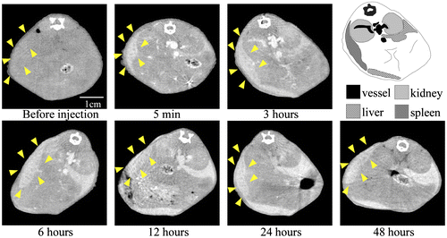 Figure 5. Change in CT value of a spleen slice before and after injection of 30-nm Au-PEG. Yellow arrowheads show the region of the spleen.