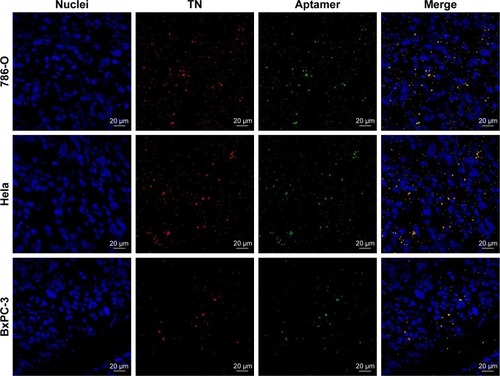 Figure 8 Ability of targeted nanobubbles to load CAIX aptamer in xenograft tumor tissues.Notes: The ability of targeted nanobubbles to load CAIX aptamer in 786-O xenograft tumor tissues (upper), in Hela xenograft tumor tissues (middle), and in BxPC-3 xenograft tumor tissues (lower). Blue fluorescence indicates cell nuclei, red fluorescence indicates the lipid membranes of targeted nanobubbles, and green fluorescence indicates CAIX aptamer.Abbreviations: TN, targeted nanobubbles; CAIX, carbonic anhydrase IX.