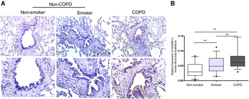 Figure 2 Comparison of airway epithelial ADAM9 expression in subjects of non-smokers, smokers, and COPD patients. (A) Immunohistochemistry staining for ADAM9 performed on sections from non-smokers (n=28), smokers (n=34), and COPD patients (n=36). Paired low (×100) and high (×200) magnification images are shown for each subject group to highlight localization of the staining. (B) Quantification of surface ADAM9 staining in lung sections from three subject groups. The boxes show the medians and 25th and 75th percentiles, and the whiskers show the 5th and 95th percentiles. **P < 0.01.