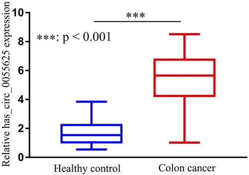 Figure 1 The relative expression of has_circ_0055625 in colon cancer patients prior to chemotherapy. Colon cancer patients that had not undergone FOLFOX treatment exhibited significantly higher has_circ_0055625 expression relative to healthy controls.
