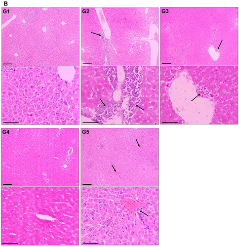 Figure 5 Effect of TQPSL on the histopathology of lungs and liver.