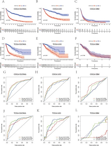 Figure 3. Survival analysis and prognostic ability of GNG5 in different database. Survival analysis in glioma (A), LGG (B) and GBM (C) patients from the CGGA database. Survival analysis in glioma (D), LGG (E) and GBM (F) patients from the TCGA database. ROC curve analysis in glioma (G), LGG (H) and GBM (I) patients from the CGGA database. ROC curve analysis in glioma (J), LGG (K) and GBM (L) patients from the TCGA database.