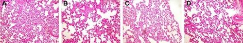 Figure 6 Histopathological analysis of inhalation toxicity.Notes: H&E staining of lung section isolated at 1 hour after injection with 1% Pluronic P123 solution (B), inhalation of saline (C) and inhalation of 1% P123 solution (D), normal lung section (A) as control.