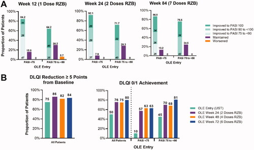 Figure 3. Changes to PASI and DLQI for UST switch patients. (A) Proportion of patients with improved, maintained, or worsened PASI scores after switching to RZB from UST reported by LOCF. (B) Proportion of patients with reduced DLQI by five or more points and achieving DLQI of 0/1 reported by mNRI for all patients and LOCF for stratified patients. RZB: risankizumab; UST: ustekinumab; LOCF: last observation carried forward; OLE: open label extension; PASI: Psoriasis Area and Severity Index; DLQI: Dermatology Life Quality Index; mNRI: modified non-responder imputation.