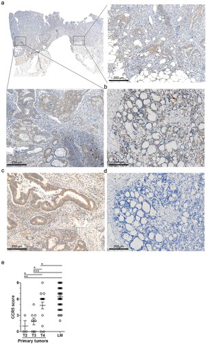 Figure 1. CCR5 expression in colorectal cancer primary tumors and metastases. Representative micro-images of CCR5 immunostaining in (a) a primary colorectal cancer specimen, in the tumor core or at the invasive margin, (b) a liver metastasis and (c) a lung metastasis of colorectal cancer. (d) Negative control immunostaining with an isotype control antibody on a liver metastasis section. (e) Results of the semi-quantitative scoring of CCR5 expression by cancer cells in primary tumors (n = 31) according to their size classification (T2: n = 3; T3: n = 8, T4: n = 20) and in liver metastases (LM, n = 84), illustrating the increase of CCR5 expression by cancer cells during cancer progression. Groups were compared using the two-tailed Mann Withney test. *: p-value < 0.05; ***: p-value < 0.0001.
