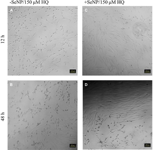 Figure 4 Phase contrast images for human dermal fibroblasts (HDF) with 150 μM HQ challenge at 12 and 48 hrs. 10× magnification. (A): –SeNP/12 hrs; (B) –SeNP/48 hrs; (C) +SeNP/12 hrs; (D) +SeNP/48 hrs. Scale bars = 100 microns.