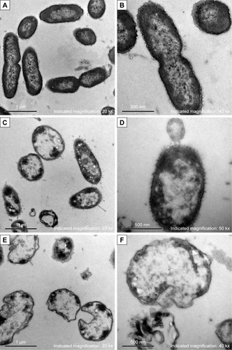 Figure 3 Morphology and structure alterations of AgNP-treated Pseudomonas aeruginosa observed by TEM.Notes: (A, B) The untreated P. aeruginosa. (C, D) The changes of P. aeruginosa post-AgNP treatment at the early stage. (E, F) The changes of P. aeruginosa post-AgNP treatment at the late stage.Abbreviations: AgNP, silver nanoparticle; TEM, transmission electron microscopy.