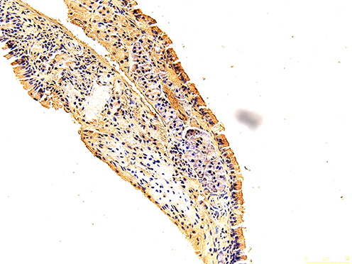 Figure 7 The immunohistochemical staining results of the day 0 group were observed under 200X microscope.