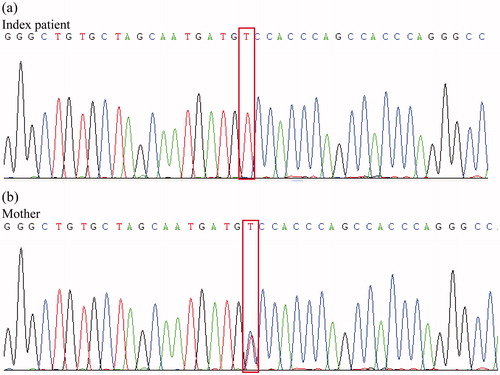 Figure 1. Sanger sequencing chromatograms of chromosome 1 at position 43,205,656–43,205,696 for the index patient (a) and the mother (b) are shown. The nucleotide changes C  > T at chr1:43,205,676 which result in CLDN19 p.Gly20Asp are highlighted by boxes. The chromatogram of the index patient shows homozygous T/T at chr1:43,205,676 while the chromatogram of the mother shows heterozygous C/T. Genomic coordinates are based on the February 2009 human reference sequence (hg19).