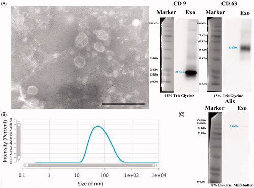 Figure 2. Identification of isolated hUCMSCs derived EXOs. (A) TEM image of EXOs, scale bar: 200 μm; (B) particle size distribution of EXOs; (C) detection of EXOs markers (CD9, CD63, and Alix) expression by western blot analysis.