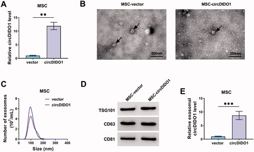 Figure 6. Identification of exosomes isolated from circDIDO1 transfected MSCs. (A) qRT-PCR analysis of circDIDO1 expression level in MSCs transfected circDIDO1 or vector. (B) TEM images of exosomes isolated from circDIDO1 or vector transfected-MSCs. Scale bar, 200 nm. (C) Exosomes isolated from circDIDO1 or vector transfected-MSCs underwent an NTA to determine exosomal size distribution. (D) Western blot analysis for exosomes markers CD63, TSG101, and CD81. (E) qRT-PCR analysis of circDIDO1 expression level in exosomes isolated from circDIDO1 or vector transfected-MSCs. **p < .01, ***p < .001.