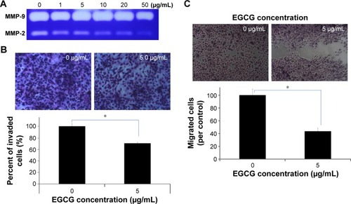 Figure 3 The effects of EGCG on the MMP activity, invasion and migration capacity of HuCC-T1 cells.