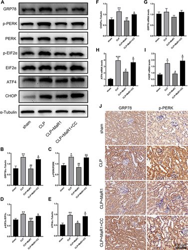 Figure 6 Compound C suppress MaR1’s effect on ER stress in SA-AKI mice. (A–F) Levels of GRP78, p-PERK, PERK, p- EIF2α, EIF2α, ATF4, and CHOP in renal tissues were measured using Western blotting. α-Tubulin was used as the internal loading control. mRNA levels of GRP78 (G), ATF4 (H), and CHOP (I) in renal tissues were examined by real-time PCR. (J) Immunostaining for GRP78 and p-PERK in mouse renal tissues (magnification 400 ×). The data are presented as the means ± SD (n = 4–6 per group). *P<0.05, **P<0.01, ***P<0.001 vs sham group; #P<0.05, ##P<0.01, ###P<0.001 vs CLP group; &P<0.05, &&P<0.01 vs CLP+MaR1 group.