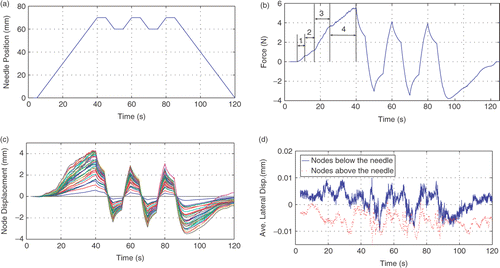 Figure 9. (a) Needle tip position; (b) Measured insertion force; (c) Axial displacement of the mesh nodes located in the US imaging plane; and (d) Average lateral displacements of the nodes above and below the needle. The needle was partially retracted and inserted again after the main insertion. Since in the second and third insertions the needle was inserted along the same path as in the first insertion, less tissue cutting occurred. Therefore, the second and third peak forces (t = 60 and 80 s) are smaller than the first one (t = 40 s). [Color version available online.]
