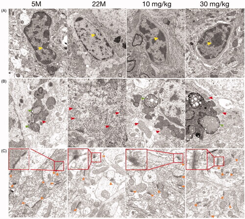 Figure 2. Effect of SPJ on the morphology of microglia and synapses in ageing rats through transmission electron microscope. The morphology of microglial nucleus (A), cytoplasm (B) and neuronal synapses (C) demonstrated that treatment with SPJ at 10 and 30 mg/kg exerted neuroprotective effect by improving damaged microglia and synapses in cortex. Yellow arrows indicate chromatin; Red arrows indicate mitochondria; Orange arrows indicate synapses.