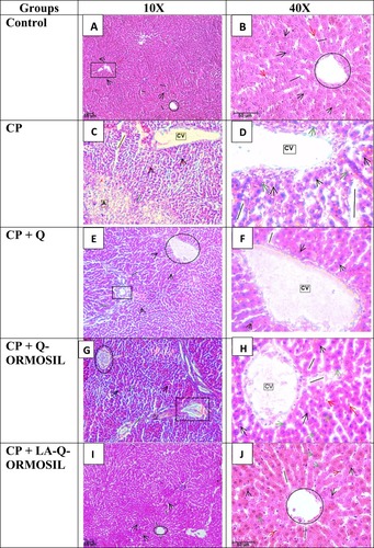 Figure 10 Rat liver histopathology (H&E) from: (A and B) control showing normal architecture of liver cells; (C and D) cyclophosphamide showing dilation and congestion of central vein and sinusoids, neutrophil infiltration, vacuolization of hepatocytes and presence of binucleated hepatocytes; (E and F) CP + Q shows dilation and congestion of central vein and sinusoids; (G–J) CP+ Q-ORMOSIL and CP+ LA-Q-ORMOSIL shows marked improvement in liver cells.