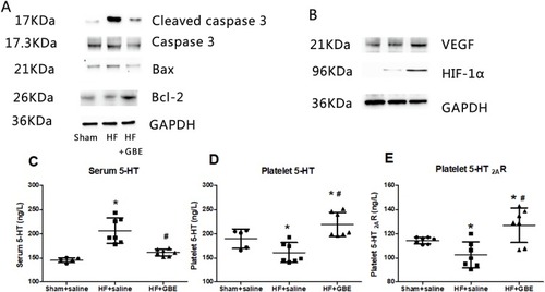 Figure 5 The anti-apoptotic function and 5-HT system regulation of GBE. (A) The expression of cleaved caspase-3, caspase-3, Bax, Bcl-2 detected by WB. (B) The expression of VEGF, HIF-1α. GAPDH was used as a loading control. (C) The level of 5-HT in serum by ELISA. (D) The level of 5-HT in platelet by ELISA. (E) The level of 5-HT2AR in platelet by ELISA. *P<0.05 comparing with sham+saline group. #P<0.05 comparing with HF+GBE group.