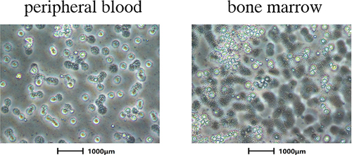 Figure 6 Myeloma cells in the peripheral blood and bone marrow of mice with MM.