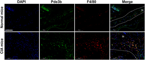 Figure 1 Arthritic mice exhibit increased Pde3b expression in synovial macrophages. Representative immunofluorescence staining results for F4/80 and Pde3b in joint sections from controls and arthritic mice. Scale bars: 100 μm. Original magnification: ×400. St, synovial tissue.