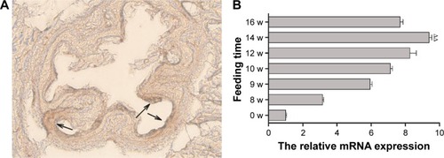 Figure 5 (A) Oil red O staining of frozen sections of the aorta, arrowhead showing lipid deposition on the arterial wall. (B) TF mRNA expressions in aorta of mouse atherosclerosis models fed with high-fat diets for various lengths of time. Data are presented as mean ± SEM; ∆∆P<0.05.Abbreviations: TF, tissue factor; SEM, standard error of mean; w, weeks.