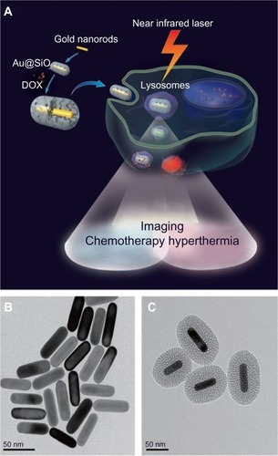 Figure 7 Mechanism of action of mesoporous silica-coated gold nanorods (A), gold nanorods without coating (B), and mesoporous silica-coated GNRs (C).Notes: The core of GNRs functioned both as an agent that allowed noninvasive imaging as well as a hyperthermic agent while the outer mesoporous silica shell encapsulated a high drug load, thus posing itself as an effective drug carrier. Reproduced from Zhang Z, Wang L, Wang J, et al. Mesoporous silica-coated gold nanorods as a light-mediated multifunctional theranostic platform for cancer treatment. Adv Mater. 2012;24(11):1418–1423.Citation104 Copyright © 2012 WILEY-VCH Verlag GmbH & Co. KGaA, Weinheim.Abbreviations: Au@SiO2, silica-coated gold nanorods; DOX, doxorubicin; GNRs, gold nanorods.