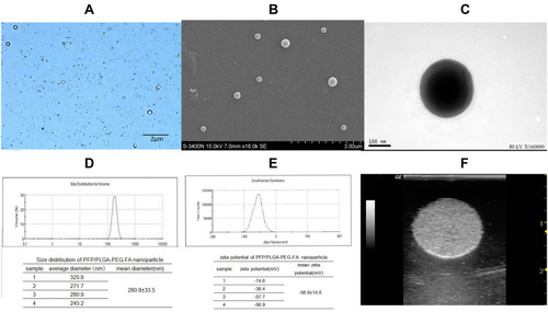 Figure 4 PFP/PLGA -PEG -FA nanoparticle characterizations.Notes: (A) Bright field optical microscopy. (B and C) SEM and TEM image of the nanoparticles. (D and E) Size distribution and zeta potential of the nanoparticles. (F) In vitro US image of the nanoparticles.Abbreviations: FA, folic acid; PEG, polyethylene glycol; PFP, perflenapent; PLGA, poly lactic-co-glycolic acid; SEM, scanning electron microscopy; TEM, transmission electron microscopy; US, ultrasound.