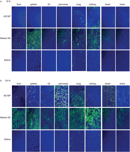 Figure 2.  The qualitative biodistribution of OPN AS NP in mammary carcinoma bone metastasis model bearing rats (intact organs). OPN AS was 5′-fluorescent labeled with FITC and encapsulated in fluorescent (rhodamine labeled) NP. Nude rats (350–400 g), implanted with mammary carcinoma cells, were treated with naked sequence or AS NP by IV injection to the rat femoral artery (n = 2). Saline treated animals were used as control groups (n = 2). Naked AS and AS NP biodistribution was evaluated by confocal microscopy of tissue samples collected after 8 h (a), 24 h (b), 72 h (c), and 7 days (d).