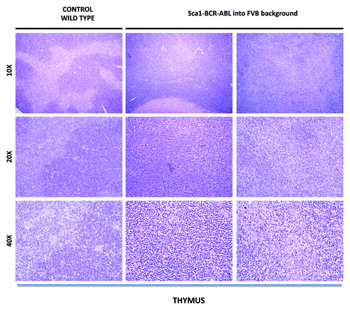 Figure 2. Representative histologic appearance of thymus of diseased Sca1-BCR-ABLp210 into FVB background and control wild-type mice after hematoxylin-eosin staining. Note the organ infiltration by blast lymphoid cells.