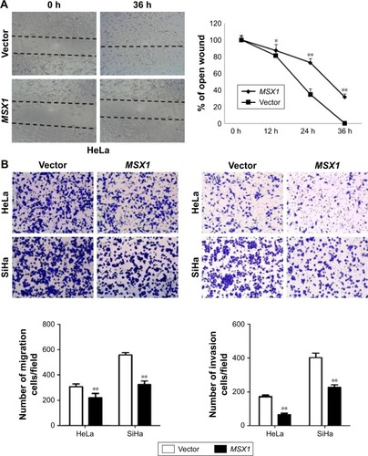 Figure 5 Ectopic expression of MSX1 inhibits cervical cancer cell migration and invasion.