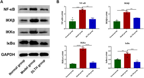 Figure 4 Treatments with intra-articular DLTH inhibit NF-κB pathway in synovial tissues of CIA rats, detected by Western blot assay. (A) Grey values of NF-κB p65, IκBα, IKKα, IKKβ bands. (B) A graphic figure of protein expressions in NF-κB pathway. Relative expression of each protein in the normal group was defined as 1. Values are represented as the mean±S.E.M. All analyses were performed after the rats were sacrificed. One-way analysis of variance (ANOVA) were performed. The significance between two groups indicated was presented as **P<0.01, ***P<0.001 and ****P<0.0001.