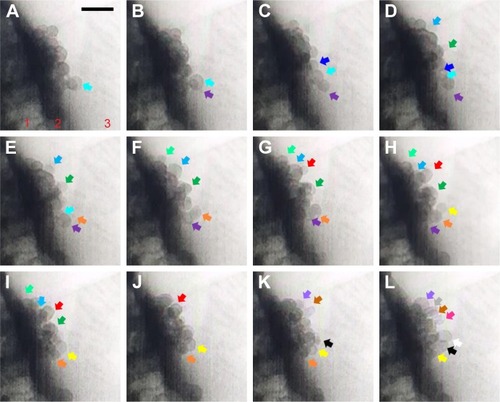 Figure 4 (A–L) TEM images from Supplementary video S2 recorded for sequential exocytosis with 0.5-second intervals. Region 1: cell, region 2: plasma membrane, region 3: cell medium. At t: 0 seconds, insulin particle with cyan arrow is shown (A). Formation and attachment of one new granule to the already anchored insulin is shown with purple arrow at t: 0.5 seconds (B), with dark blue arrow at t: 1 seconds (C), with light blue and dark green arrows at t: 1.5 seconds (D), with light green arrow at t: 2 seconds (E), with orange arrow grows at t: 2.5 seconds (F), red arrow at t: 3 seconds (G), yellow arrows at t: 3.5 seconds (H), at t: 4 seconds (I), at t: 4.5 seconds (J), with black, purple and brown arrows at t: 5 seconds (K), white, gray and pink arrows at t: 5.5 seconds (L). Attraction of these particles toward themselves (E) and retrieval of these granules by time toward PM is monitored as well. Scale bar: 200 nm.Abbreviations: TEM, transmission electron microscopy; PM, plasma membrane.