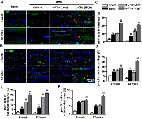 Figure 6 α-Chaconine activates NF-κB signaling pathway of knee joint. (A and B) Immunofluorescence staining of p65 and p-i-κBα both in articular cartilage and subchondral bone 8 and 12-week post-surgery. (C and D) Quantification of p65 and p-i-κBα positive cells in cartilage. (E and F) Quantification of p65 and p-i-κBα positive cells in subchondral bone. Red arrows indicate the positive expression of p65 and p-i-κBα. Data are expressed as the mean ± SD. **P < 0.01 vs Sham group, ##P < 0.01 vs Vehicle group.