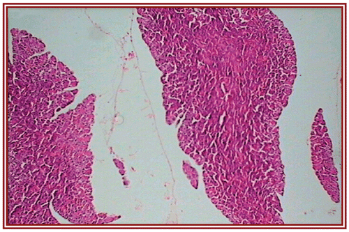 Figure 3.  STZ + Embelia ribes ethanol extract treated group (i.e., group II) rat heart section, showing normal myocardial fibers (×10).