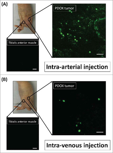 Figure 1. Distribution of fluorescence imaging. (A) S. typhimurium-A1-R-GFP targeting the osteosarcoma PDOX after intra-arterial (i.a.) injection. (B) S. typhimurium A1-R-GFP targeting the osteosarcoma after intravenous (i.v.) injection. Confocal microscopy imaging with the Olympus FV1000 demonstrated S. typhimurium A1-R-GFP targeting the osteosarcoma PDOX. Scale bars: 12.5 µm.