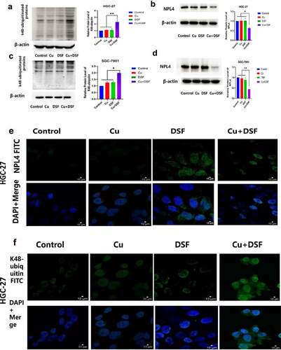 Figure 5. DSF/Cu increases K48-ubiquitinated protein accumulation and induces NPL4 aggregation. HGC-27 and SGC-7901 were exposed to Cu (0.2 μM), DSF (0.24 μM, 0.3 μM), and DSF + Cu (0.24 μM, 0.3 μM + 0.2 μM) for 24 h. (a–d) Expression levels of K48-ubiquitinated protein with NPL4.β-actin as the loading control. (e–h) DSF/Cu induces rapid cytoplasmic accumulation of K48-ubiquitinated proteins. NPL4 aggregation was visualized using immunofluorescence staining after pre-extraction. Scale bar: 10 µm. Data are expressed as mean ± standard of three independent experiments. *p < 0.05 vs. the DSF/Cu group.