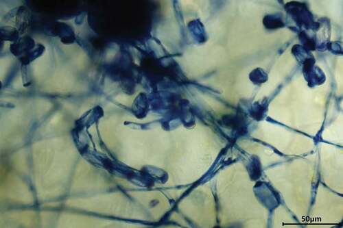 Fig. 2 Fungal structures of P. xanthii on host leaf surface. The structures were stained with trypan blue.