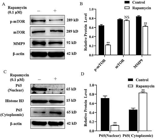 Figure 2. Rapamycin decreased MMP9 expression and P65 nuclear translocation in mammary epithelial cells. (A) Mammary epithelial cells were pretreated with Rapamycin. The expression of p-mTOR, mTOR and MMP9 were measured by Western blot analysis. β-actin expression was evaluated as an internal control. (B) Quantification of p-mTOR, mTOR and MMP9 expression from the Western blots in panel A. (C) Mammary epithelial cells were treated with Rapamycin. Nuclear and cytoplasmic extracts were prepared, and Western blot analysis was performed. Histone H3 and β-actin were used as an internal control for nuclear and cytoplasmic extracts, respectively. (D) Quantification of nuclear and cytoplasmic P65 expression from the Western blots in panel C. Data are expressed as mean ± SEM of three independent experiments. *p < 0.05 and **p < 0.01 compared with the control.