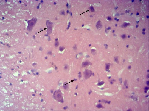 Figure 1 Representative picture of neurons by HE staining.