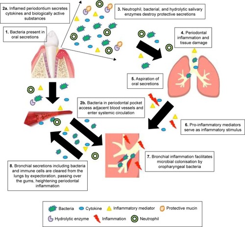 Figure 2 Shared inflammatory mechanisms that might facilitate disease progression in both COPD and periodontitis.