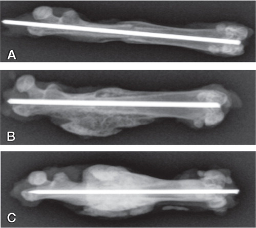 Figure 2. Radiographs of the median samples from each group (based on callus volume) after harvest at 6 weeks.A. Group A (autograft group) with fracture line still visible.B. Group B (autograft + BMP) showing larger calluses than in group A.C. Group C (autograft + BMP + zoledronate) showing an even larger callus and a denser appearance, reflecting increased BMD.